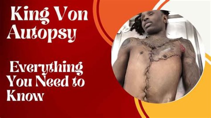Autopsy of King Von: A Deep Dive into the Life and Death of a Hip-Hop Legend