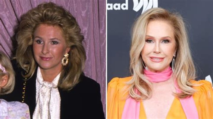 Has RHOBH Kathy Hilton Done Plastic Surgery? Fans Suspect Botox And Nose Job ·